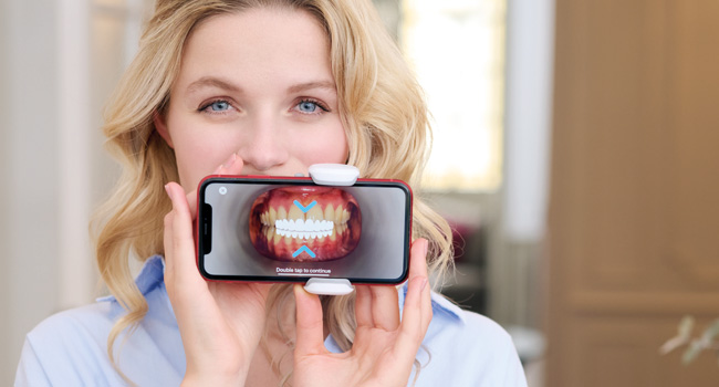 So funktioniert Dental Monitoring®